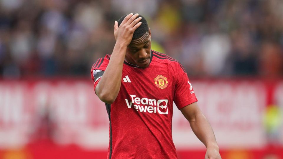 Manchester United’da Anthony Martial şoku